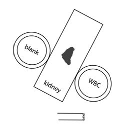 Making a Bottle of Left Kidney's WBCs